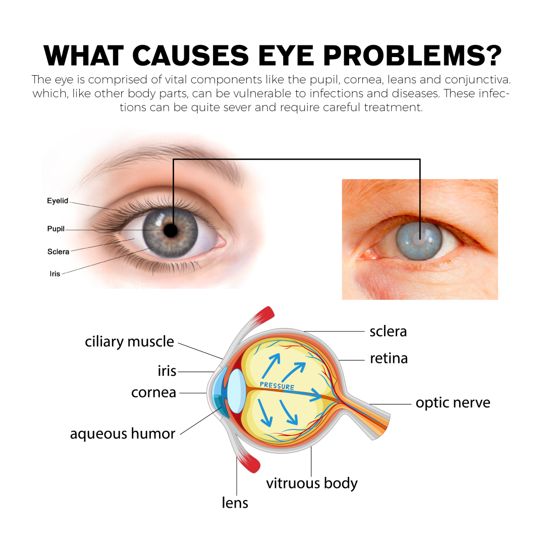 (Lleva 2x1)🎁NAFAZOLINA + HIPROMELOSA + CONDROITINA (Contra el ojo irritado, PREVIENE CEGUERA)