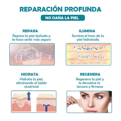 SCARREMOVE - SPRAY ANTICICATRICES, ACNÉ, ESTRÍAS...⚡️
