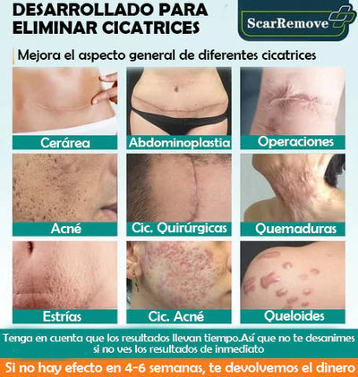SCARREMOVE - SPRAY ANTICICATRICES, ACNÉ, ESTRÍAS...⚡️