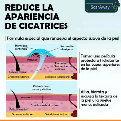 SCARREMOVE - SPRAY ANTICICATRICES, ACNÉ, ESTRÍAS...⚡️